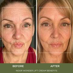 Noor Wonder Lift Cream packaging highlights a gentle formula.