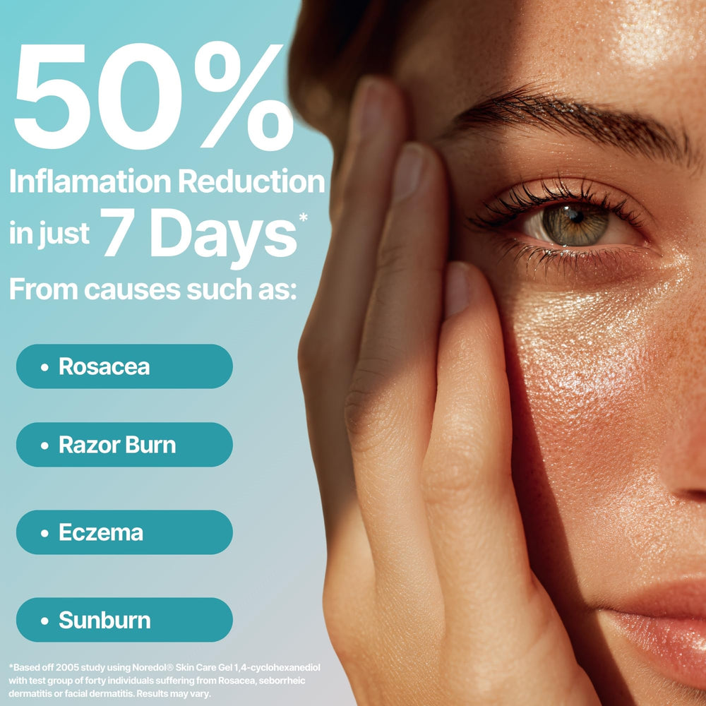 Noredol gel applied on skin with instant cooling and calming effect.