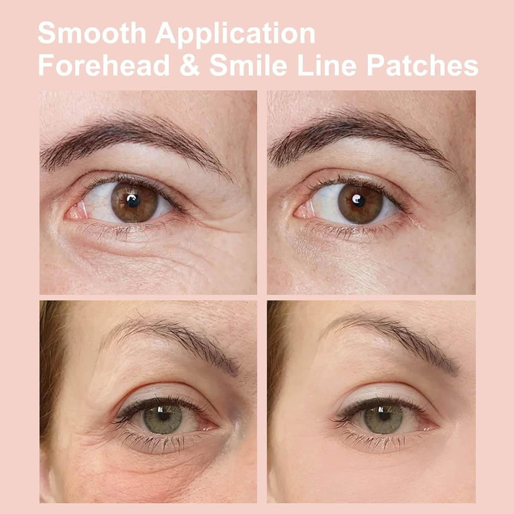 NOVALIFT Kunnozz forehead hydration mask nourishes dry skin for a plumper look