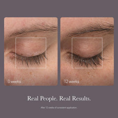 NULASTIN clinical trial chart image reflects measured lash length growth.