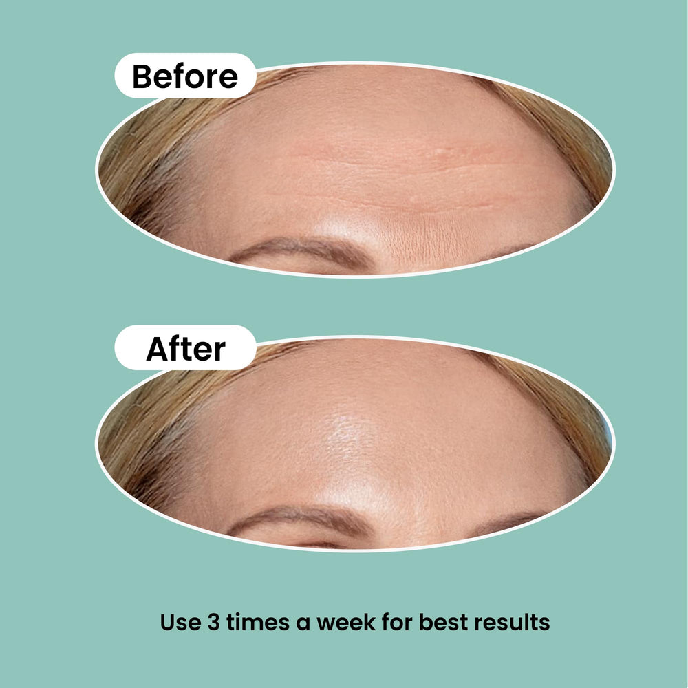 NURIVE Patches leave no sticky residue for easy removal in the morning.