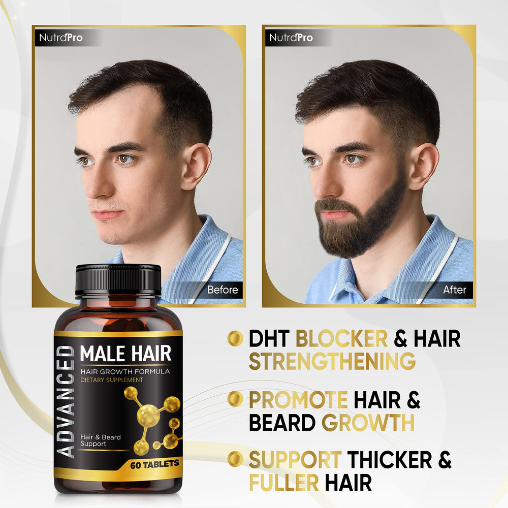 NutraPro hair growth vitamins packaging designed for thinning hair at the hairline and crown.