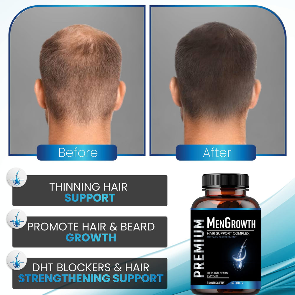 NutraPro MenGrowth beard-growth visual suggesting possible grooming benefits.