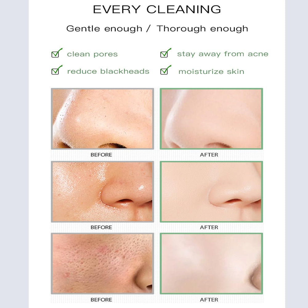 nvyue blackhead remover mask stick targets impurities for clearer pores
