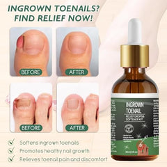 NWAKRD applicator enables precise, mess-free toe nail application