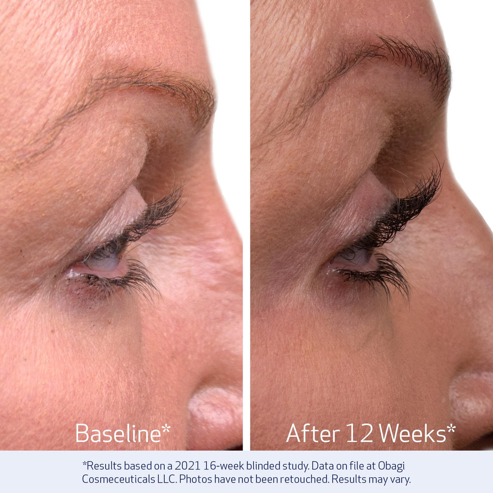 Lashes showing visible improvement over time with Obagi Nu-Cil serum