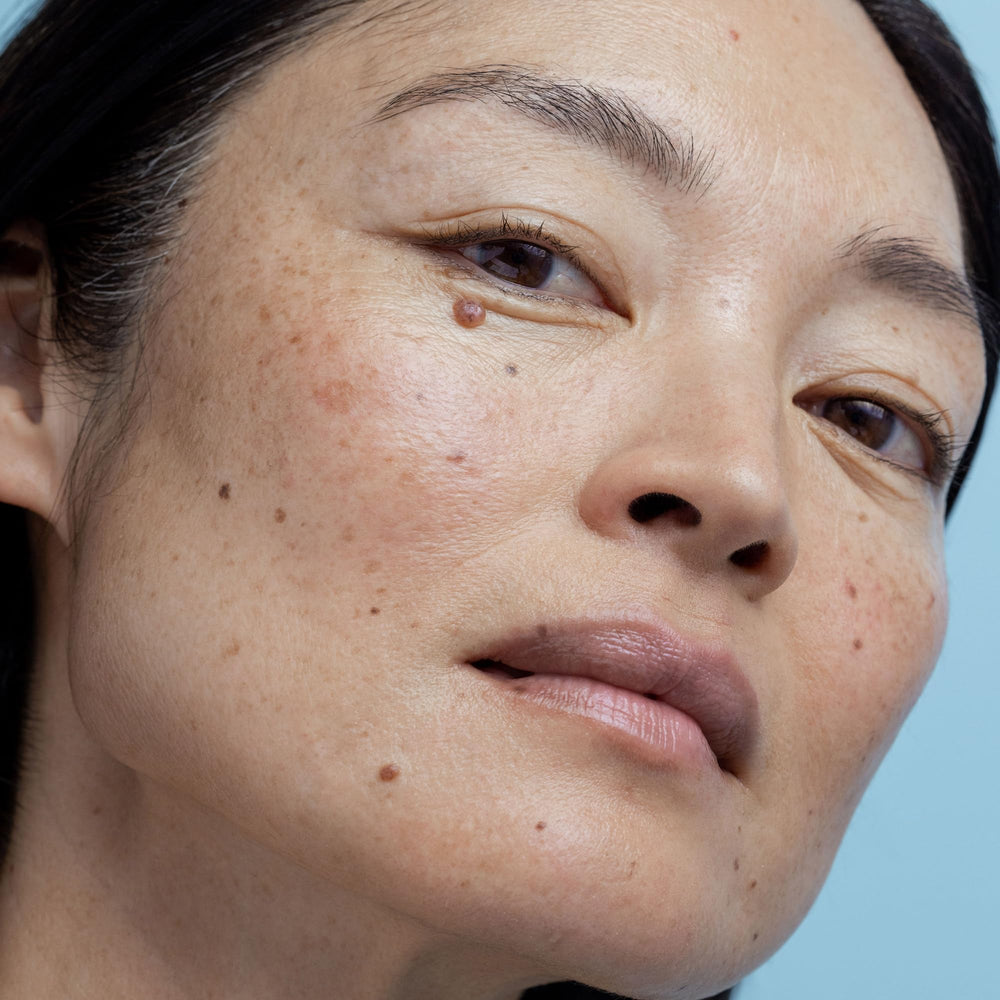 Obagi Nu-Derm Exfoderm Forte after-use glow suggests skin renewal and brighter appearance.