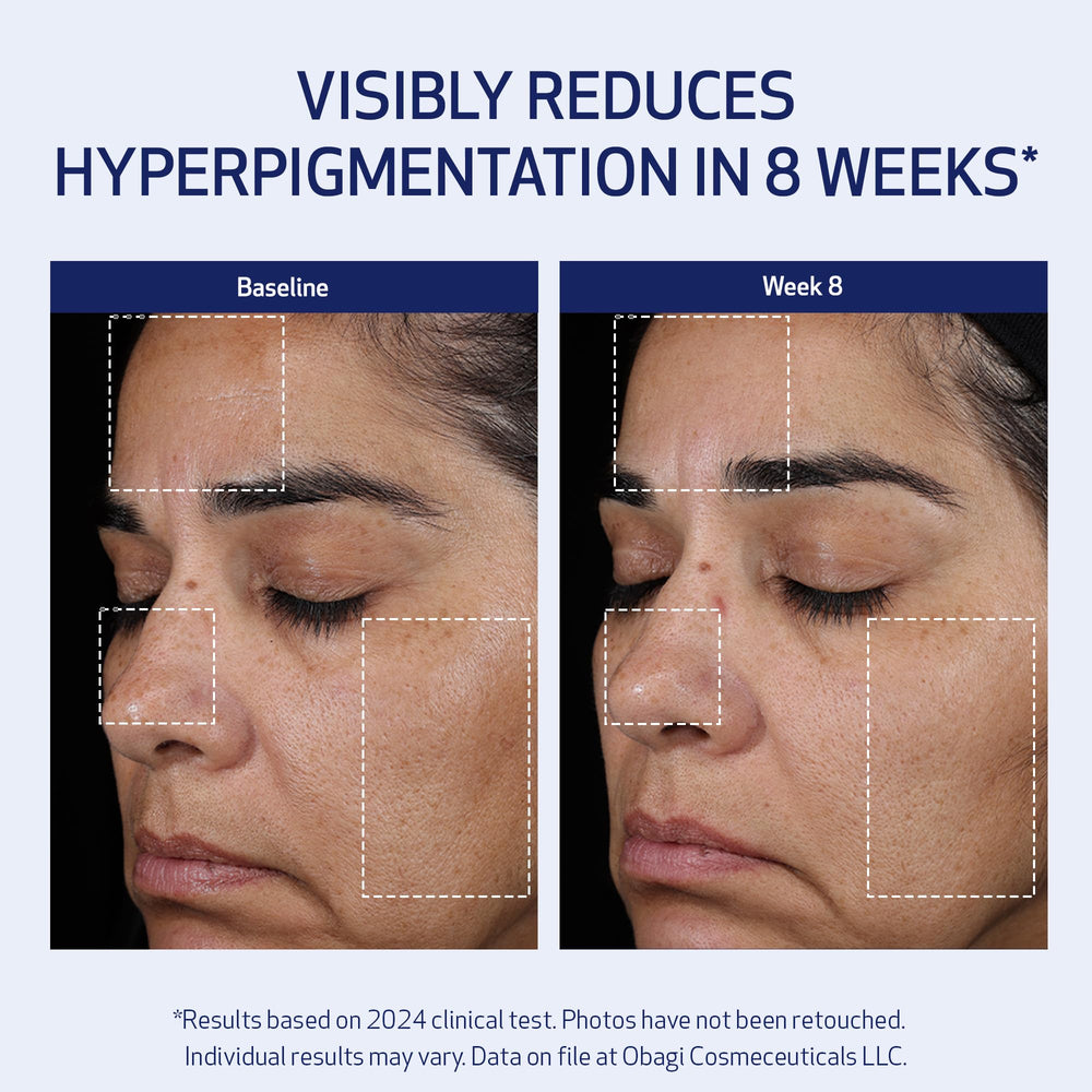 Obagi Claribright texture-focus suggests smoother skin over time
