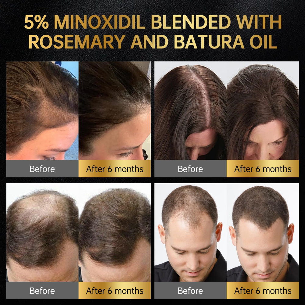 OCSINL Minoxidil massage tool close-up reaches hair roots