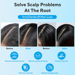 Oiangna anti-fungal shampoo color-treated hair compatibility close-up