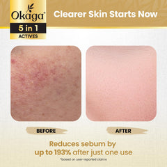 Okaga Rice Peel Shot Ampoule application on hand demonstrates easy daily use.