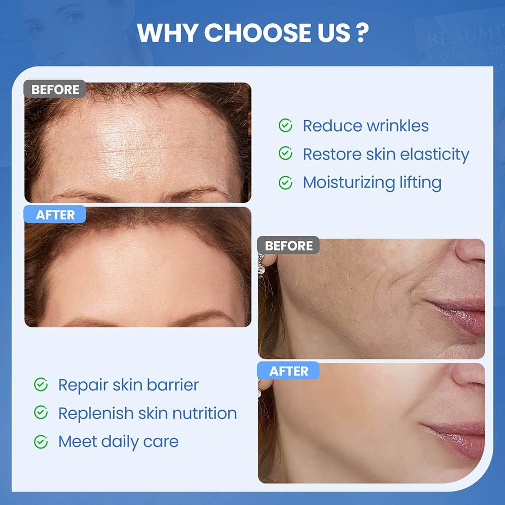 Okela smile line patches placed around the mouth for a refreshed morning look