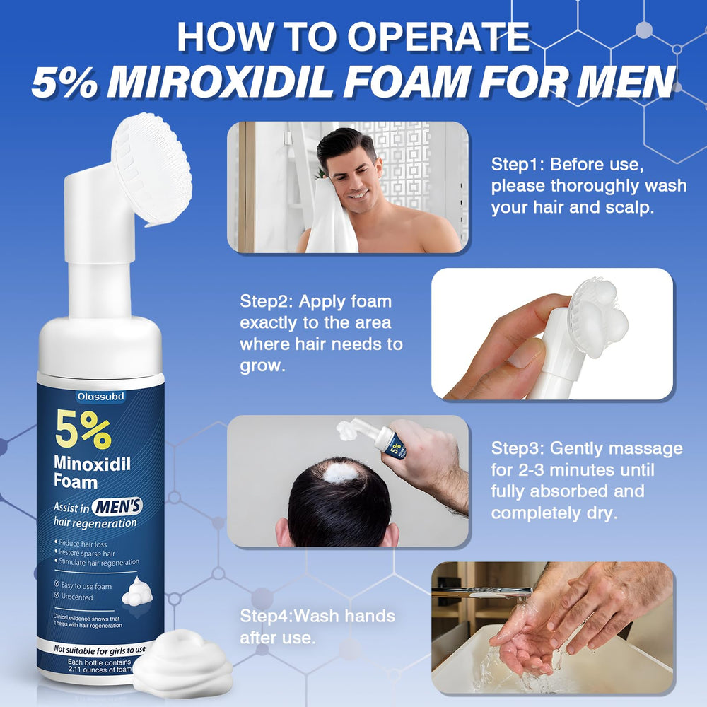 Detailed view of Olassubd Minoxidil 5% Foam on the scalp for even distribution.