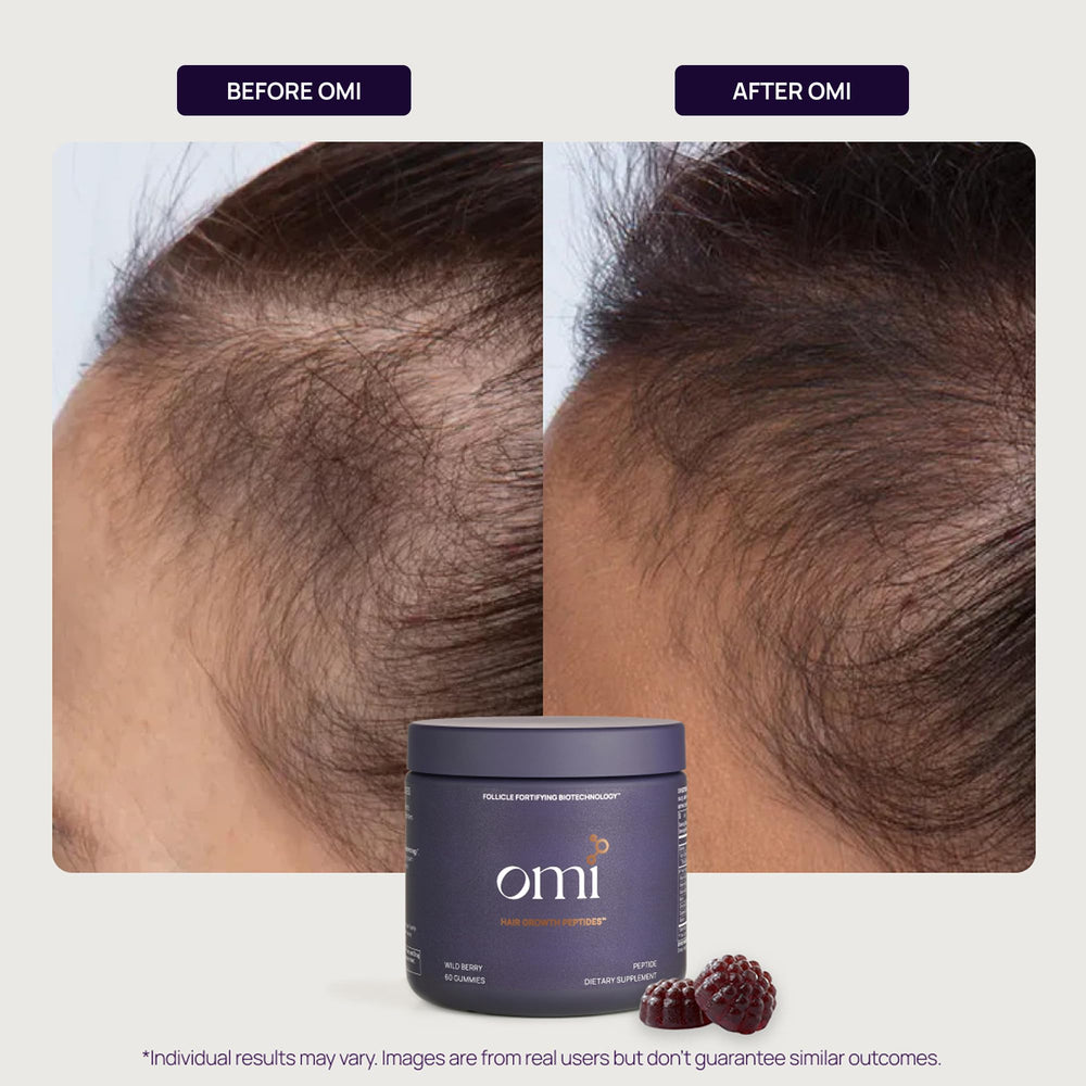 OMI Hair Growth Peptides Gummies ingredient list highlights essential vitamins for follicle support.