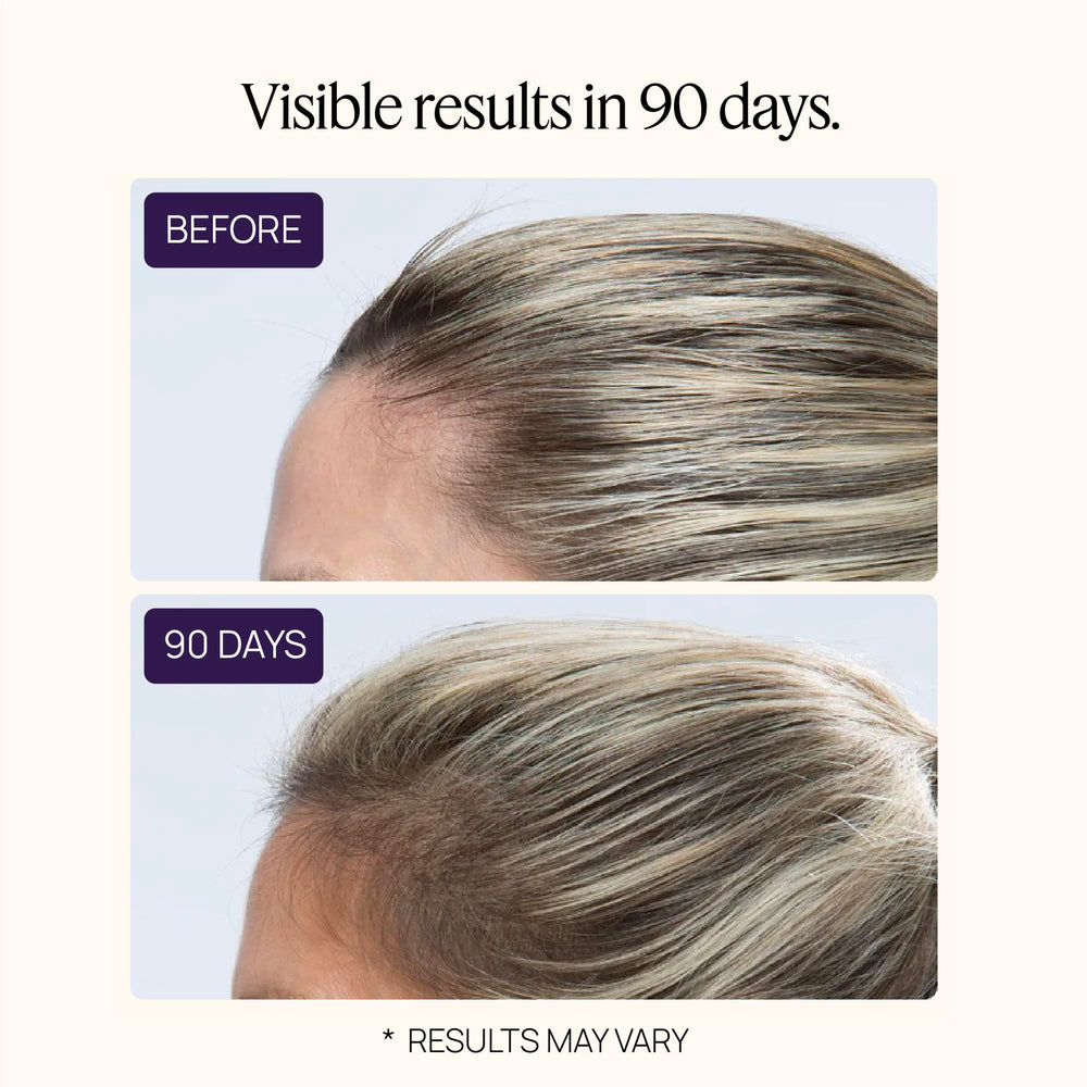 OMI WellBeauty patented-technology diagram illustrates the biotechnology behind follicle fortification.