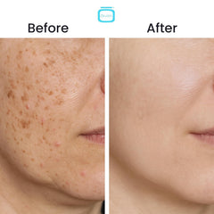 OMIC+ Skincare radiant skin after application