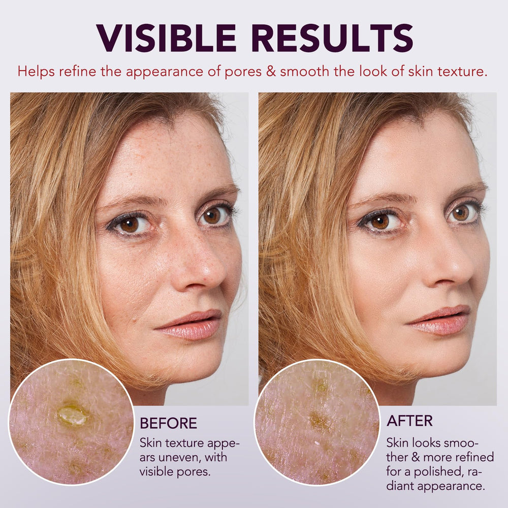 Close-up showing potential texture improvement and refined pores with OMZOK