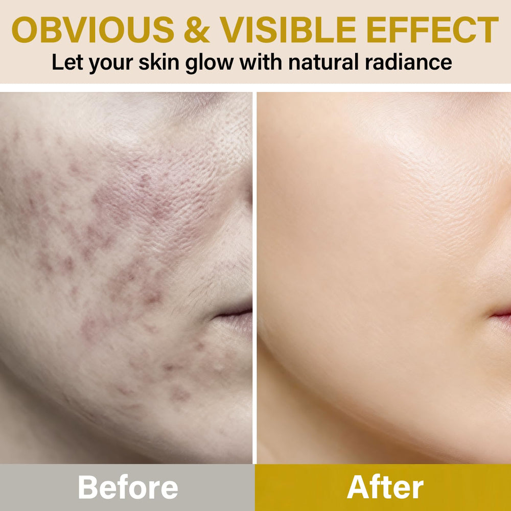 Onzzyl Bee Venom Cream daily-use skincare suitable for all skin types.