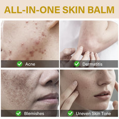 Onzzyl Bee Venom Cream lightweight texture for fast absorption and comfort.