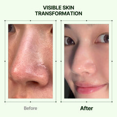 Orien Mugwort Zero Film Cleansing Oil sebum melt feature for clearer pores.