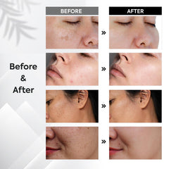 oudetas dark spot remover applicator close-up—360-degree roller for even actives