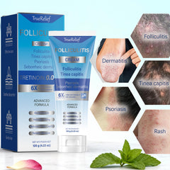 OUHENGTEK Folliculitis Cream flat-lay on bathroom shelf.