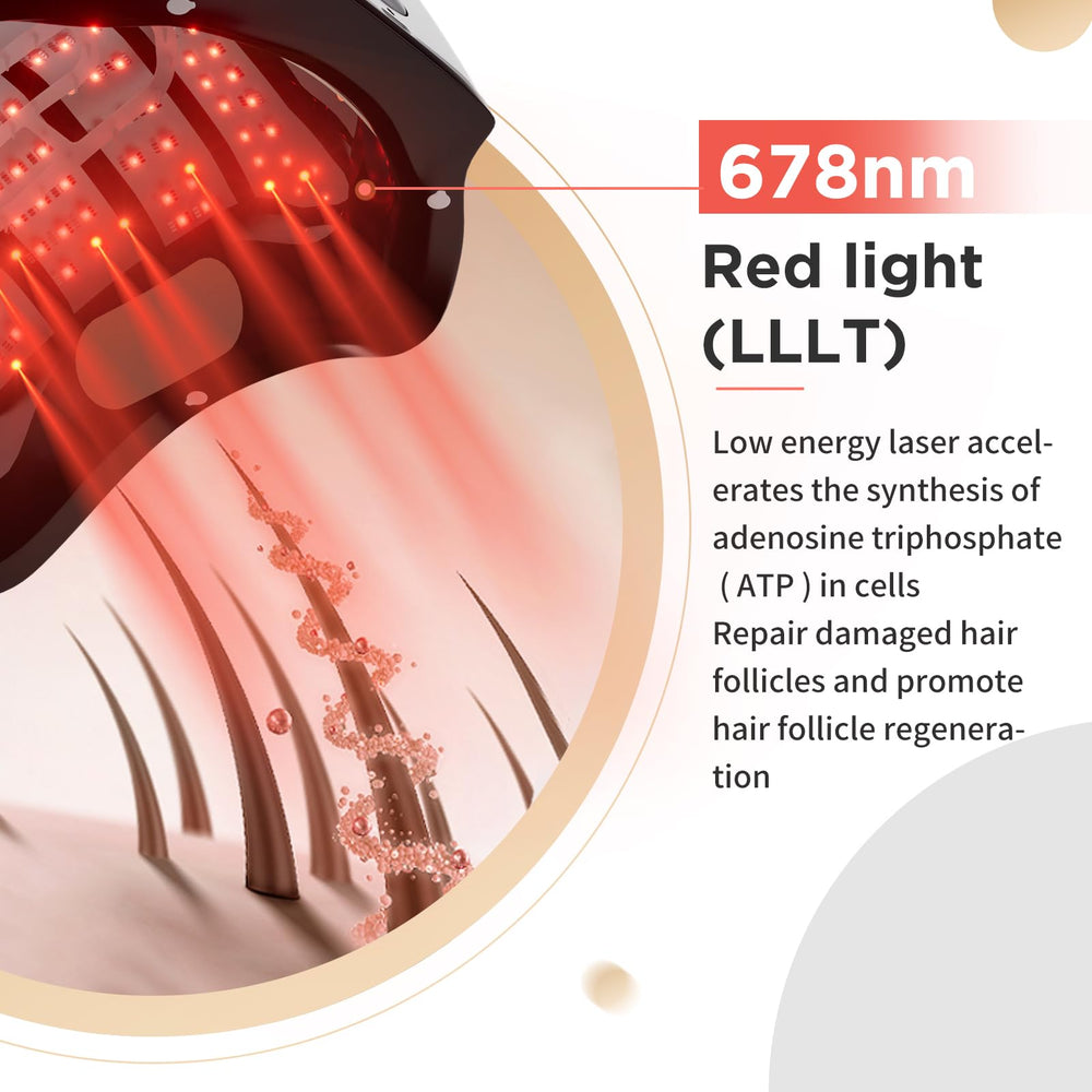 OVEKPA 162-diode laser array provides broad scalp coverage for thinning areas