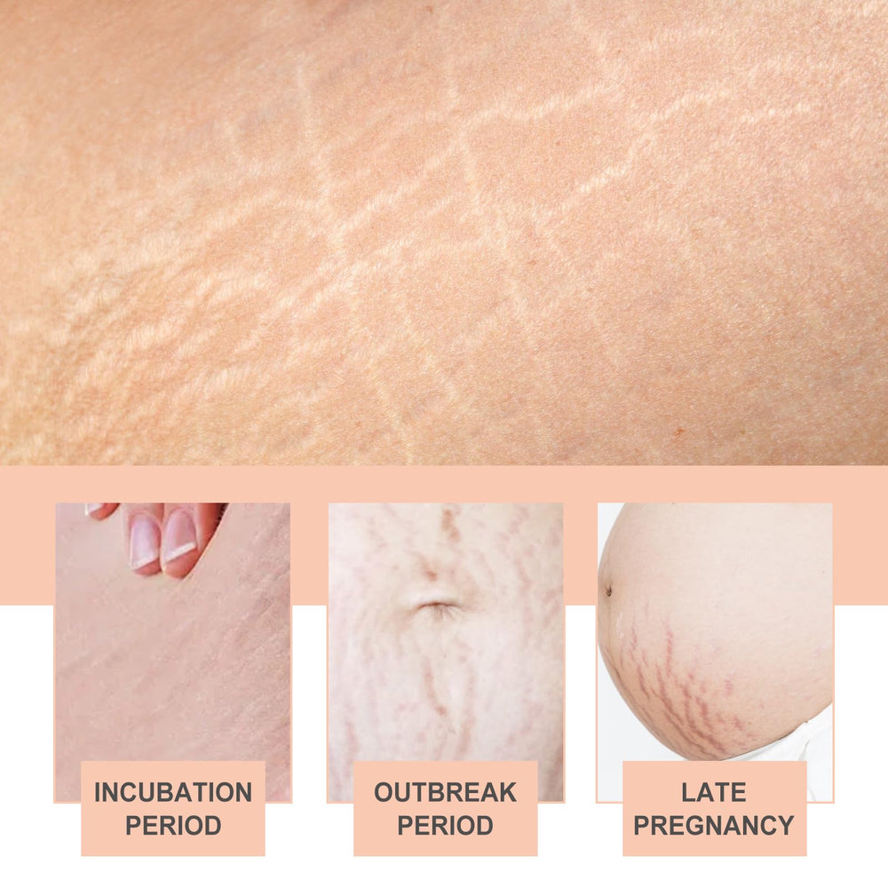 OWILIWO anti-wrinkle cushion providing soft contact with skin