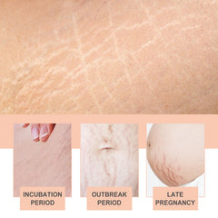 OWILIWO anti-wrinkle cushion providing soft contact with skin