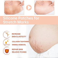 OWILIWO stretch-marks patch on belly area showing discreet wear