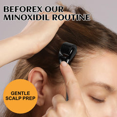 Pabedo 5% Minoxidil scalp nourishment promotes healthier-looking hair.