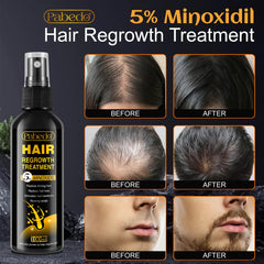 Pabedo minoxidil bottle packaging box highlights premium formula.