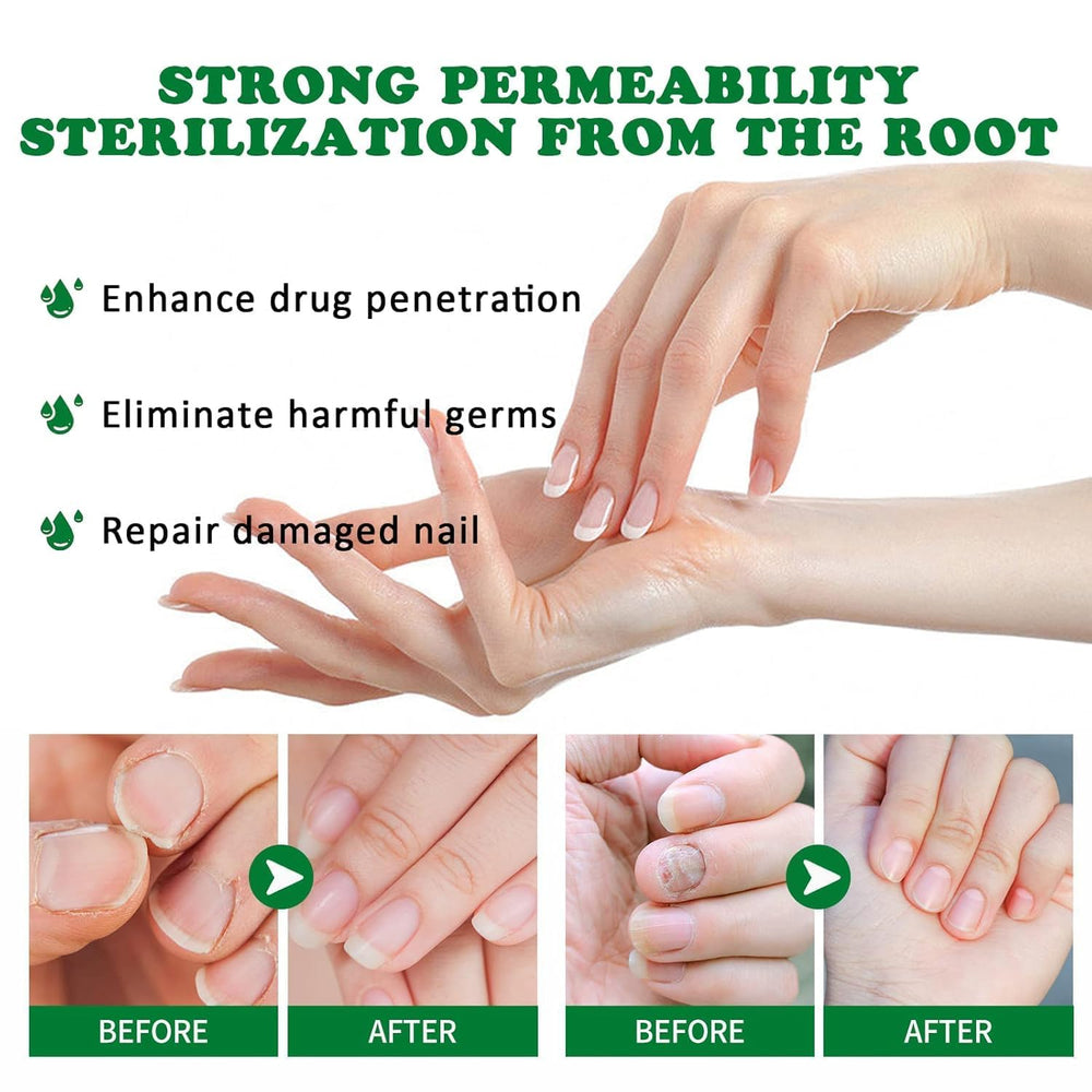 PARWENE Nourishing Formula nails closeup emphasizes hydration and flexible nail surface