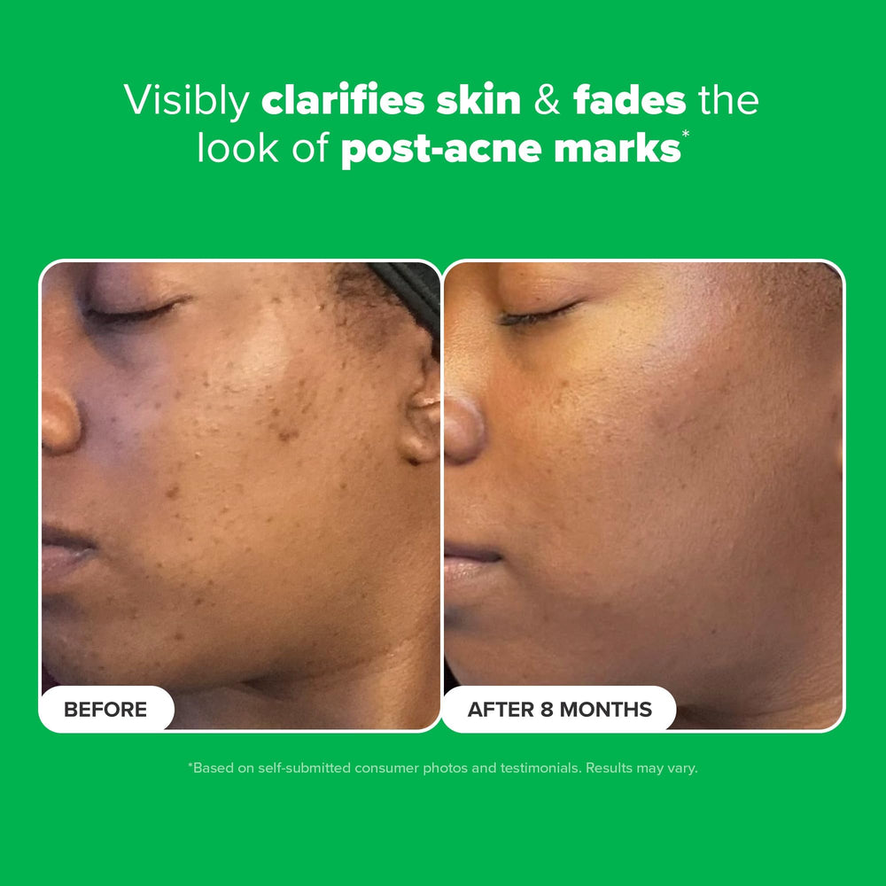 Oil-free Paula's Choice Boost serum texture ready for daytime use