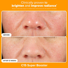 Paula's Choice C15 Booster Serum; vitamin C for even tone and subtle glow.