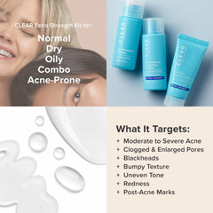 Paula's Choice CLEAR acne travel kit packaging visible for on-the-go care.