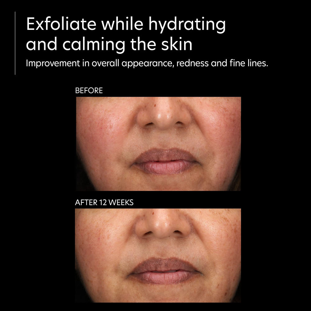 PCA SKIN Resurfacing Serum packaging signals trusted at-home care.