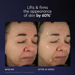 PCA SKIN Pro Max Age Renewal neck and face closeup suggesting smoother texture.