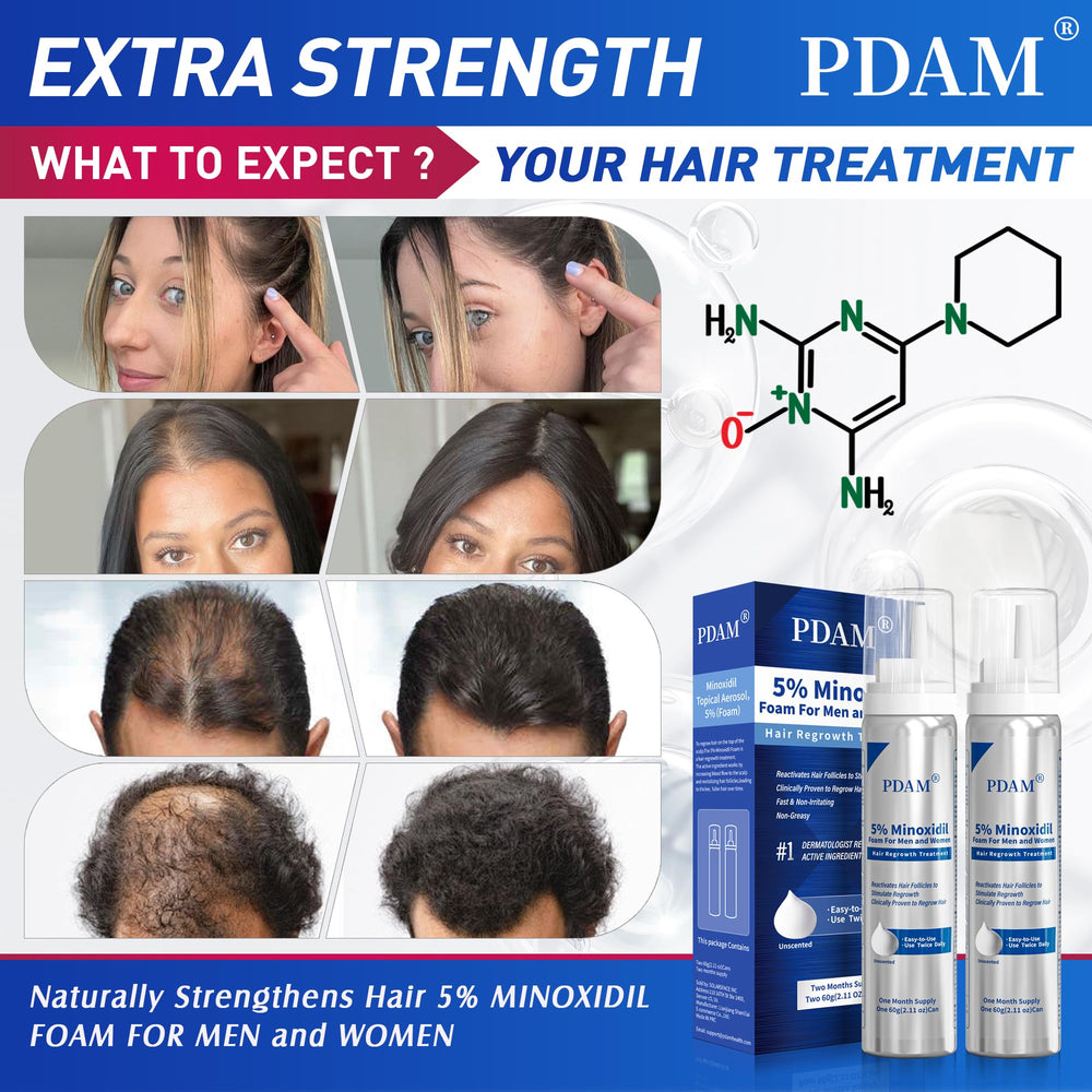 Pdam Minoxidil foam dispensing tip for easy application