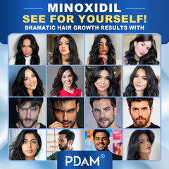 Pdam Minoxidil packaging 6 oz bottle for long lasting supply