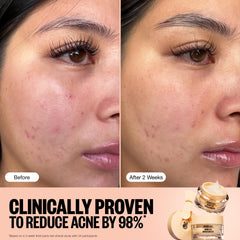 PEACE OUT Acne Gel Moisturizer packaging displays clean design for everyday use