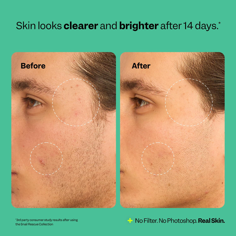 Close-up of Peach Slices Snail Rescue Toner texture conveying lightweight feel