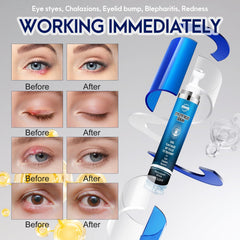 PENNTR plant-based formula eye serum highlights natural ingredients