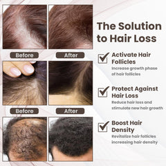 Calming scalp care setup with PeptideLabz routine.