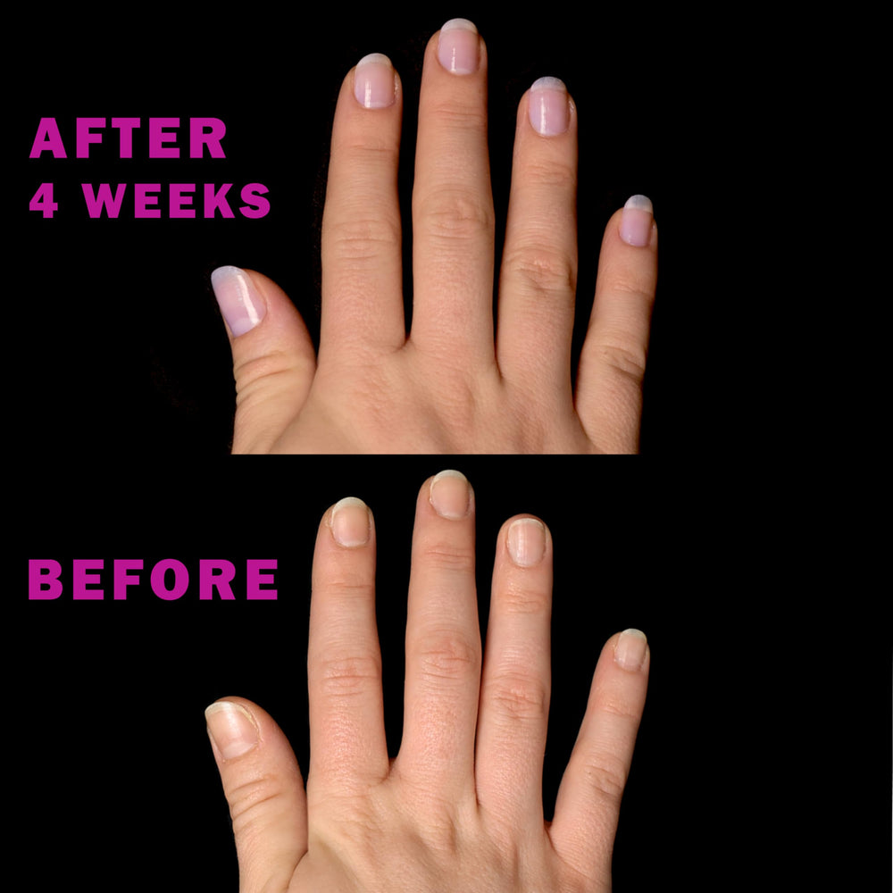 Perfect Formula Keratin Nail Treatment Kit supports healthier nails at home.