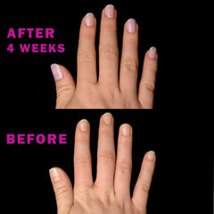 Perfect Formula Keratin Nail Treatment Kit supports healthier nails at home.