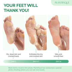 PLANTIFIQUE Foot Peeling Mask 4 Pack packaging highlighting dermatological safety