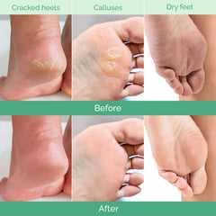 PLANTIFIQUE Foot Peeling Mask soaking scene shows prep step