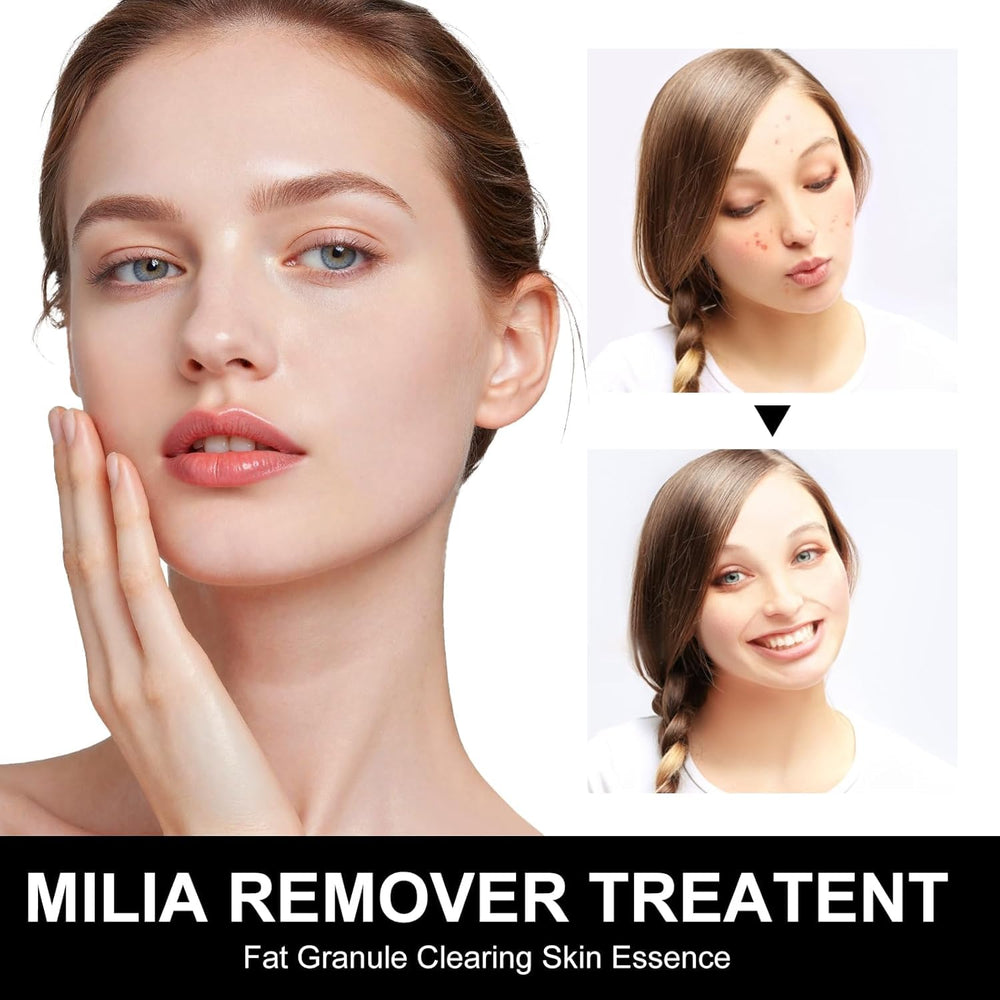 Platicat Milia Remover Serum applied around eye-area for delicate spot care
