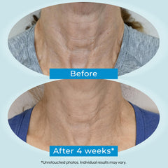 Plexaderm Neck Cream bottle being spread on skin for hydration